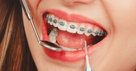 How General Dentistry And Orthodontics Work Hand In Hand For A Healthy Smile