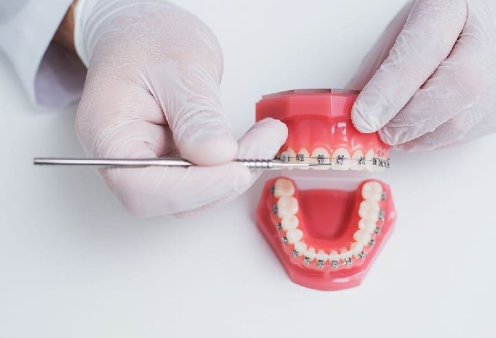 How Cosmetic Dentistry And Orthodontics Work Together For A Perfect Smile