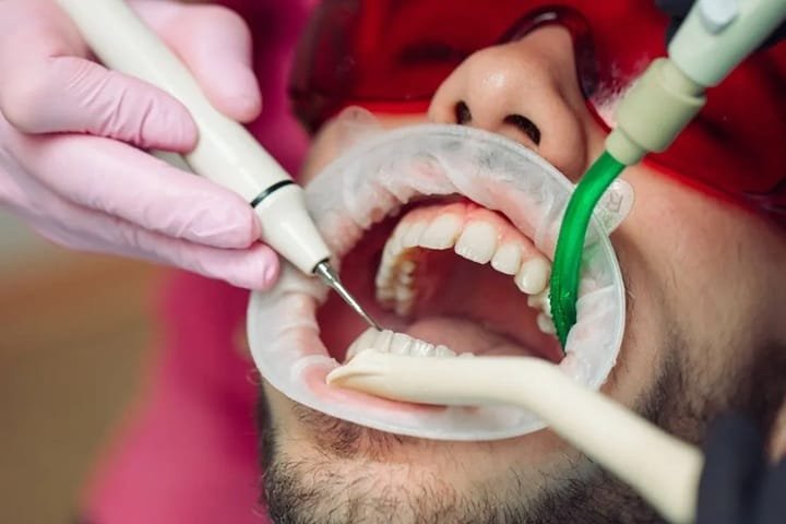The Top Benefits Of Professional Dental Cleanings