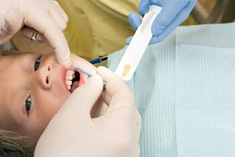 The Importance Of Fluoride Treatments In General Dental Care