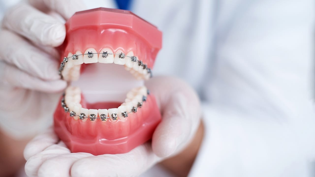 How Orthodontics Plays A Role In Facial Aesthetics