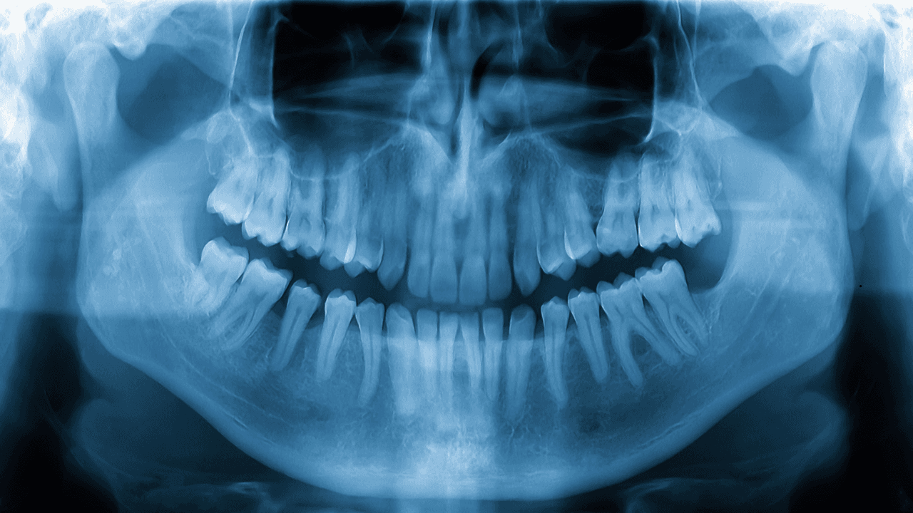 The Role Of X Rays In General Dentistry