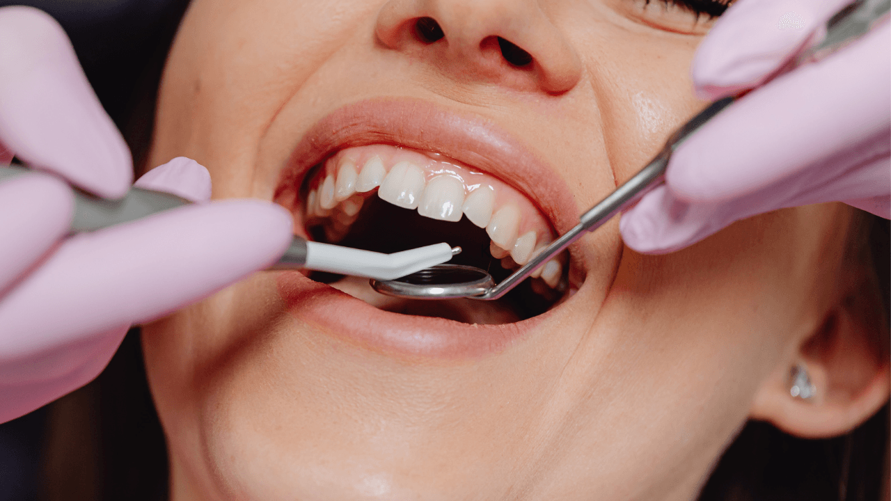 The Importance Of Fluoride Treatments In General Dental Care